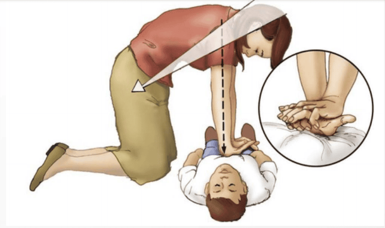 Cấp cứu ngừng tuần hoàn: Phác đồ chuẩn và kỹ thuật nâng cao